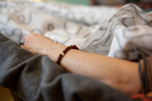 The arm of a white woman rests on a grey fleece blanket.  There is a single acupuncture needle visible.  She is wearing a brown meditation bracelet, and a large turquoise ring on her left hand. 